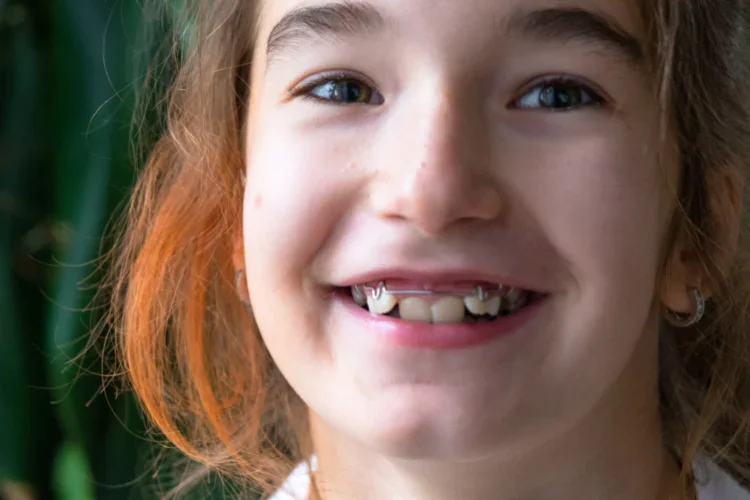 Parent learning the signs their child may need orthodontic treatment